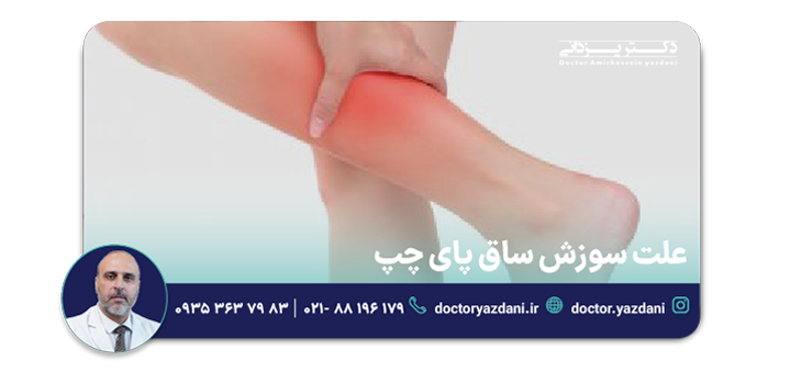 علت سوزش ساق پای چپ